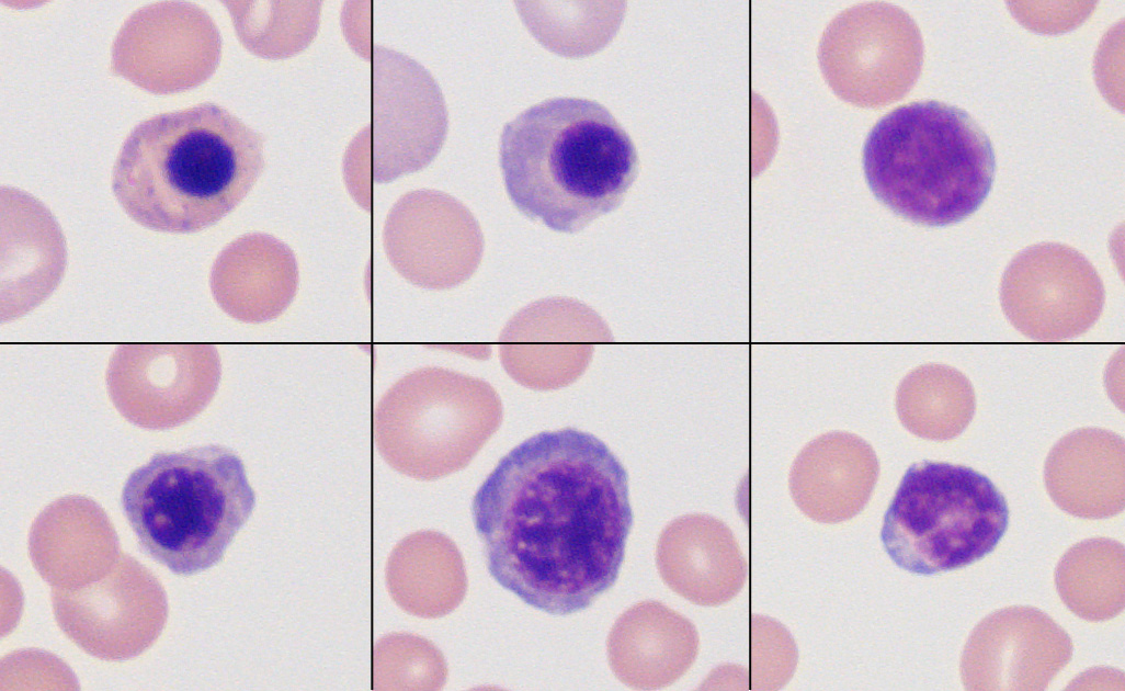 image-gallery-nucleated-red-blood-cells