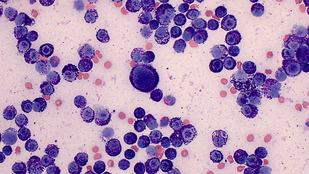 mast cell Archives | eClinpath