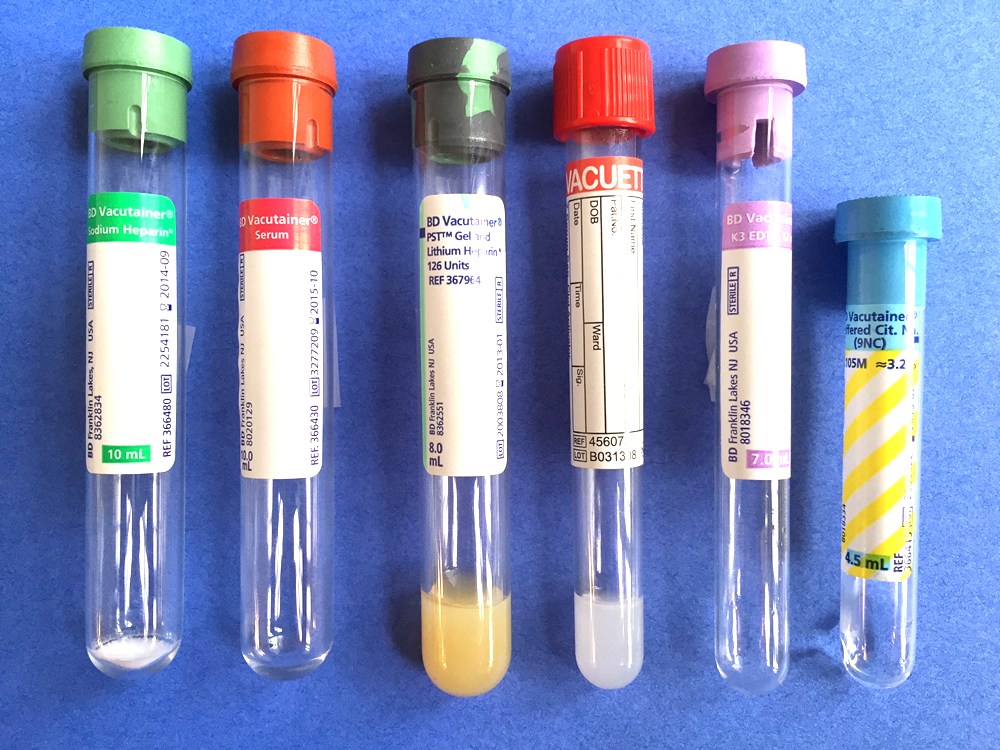 Blood Test Tube Color Chart