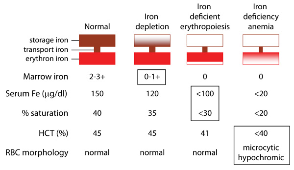 Development of iron deficiency anemia | eClinpath