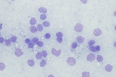 Artifacts (cytology)