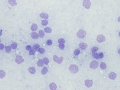 Smudged cells