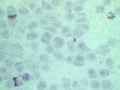 Understained smear