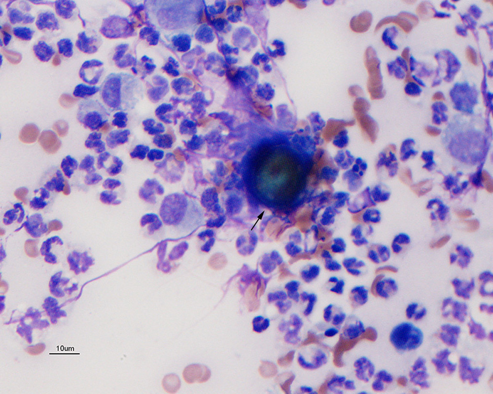 Artifacts (cytology) | eClinpath