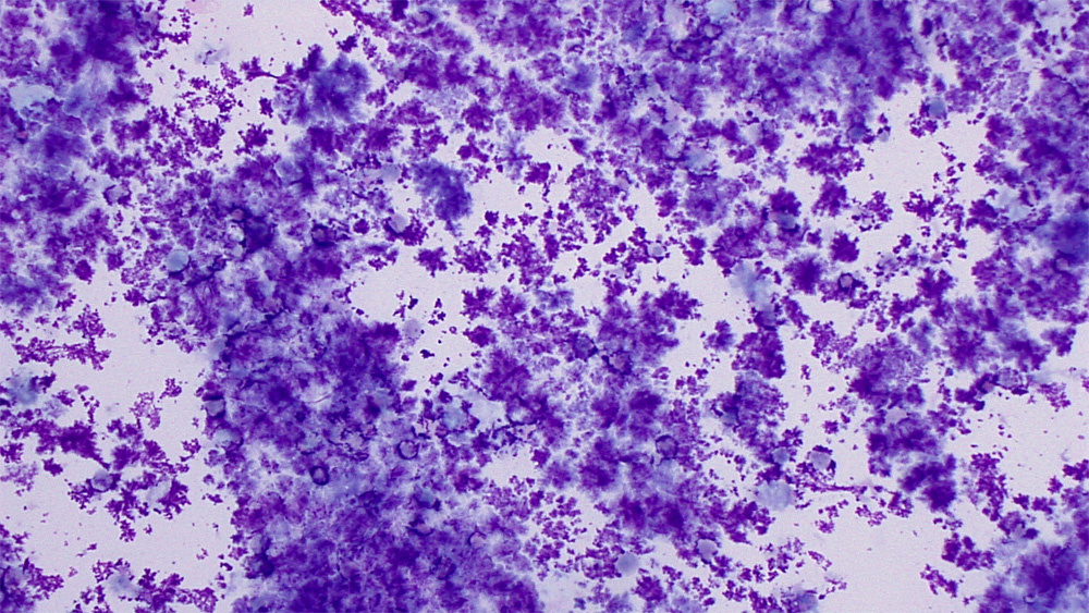 Artifacts (cytology) | EClinpath