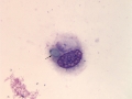 Dematiaceous spore