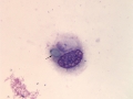 Dematiaceous spore (horse)