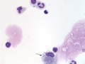 Severe asthma (horse)