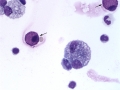 Severe asthma (horse)