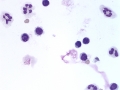 Severe asthma (horse)