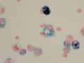 EIPH (prussian blue)