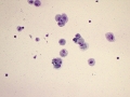 Exercise-induced pulmonary hemorrhage (EIPH, horse)