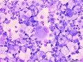 Equine multinodular pulmonary fibrosis (EMPF)