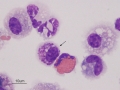 Eosinophilic & mastocytic asthma (horse)