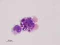 Eosinophilic & mastocytic asthma (horse)