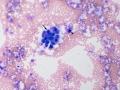 Suspect carcinoma (dog)