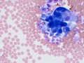 Suspect carcinoma (dog)