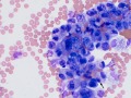 Suspect carcinoma (dog)
