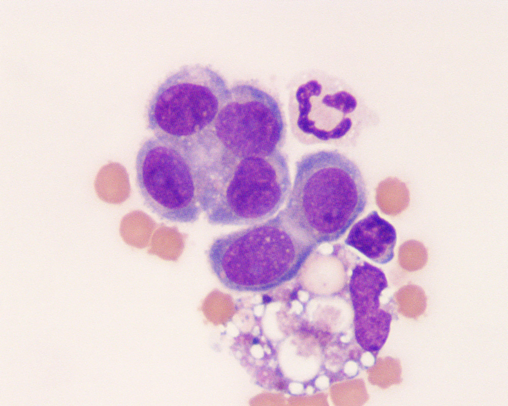 Mesothelial cells