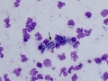 GI rupture + yeast