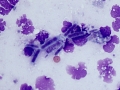 GI rupture + yeast