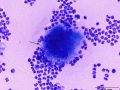 Actinomyces (presumptive)