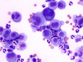 Mesothelial cells