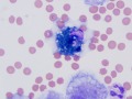 Lipofuscin in macrophage