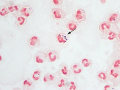 Septic peritonitis (GS)