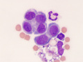 Mesothelial cells