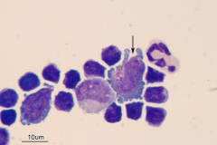 Cerebrospinal fluid