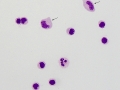 Neuroborreliosis (horse)