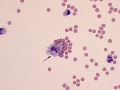 Erythrophage
