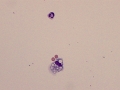 Neutrophil & macrophage