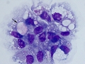 Intracellular myelin
