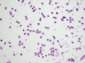 Neuroborreliosis (horse)