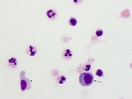 Neuroborreliosis (horse)
