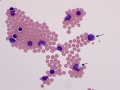 Necrotizing leukoencephalomyelitis (MUE, pug)