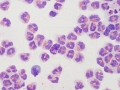 Eosinophilic inflammation (camelid)