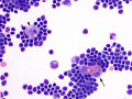 Cytophagia