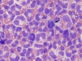 Eosinophilic inflammation (dog)