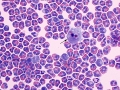 Eosinophilic inflammation (dog)