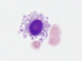 Leptomeningeal or dural cell