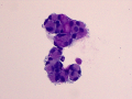 Leptomeningeal cells