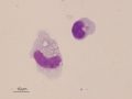Granular lymphocyte