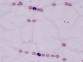 SRMA (joint)