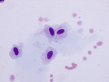 Leptomeningeal cells
