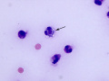 Sepsis (Orangutan)