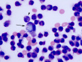 Sepsis (Orangutan)