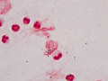 Sepsis (Orangutan, gram)